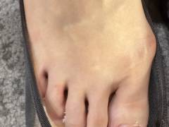 真夏に素足にパンプスで蒸れた足の裏