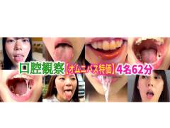 【特価】口腔観察VOL.4　4名62分お買い得セット nko04
