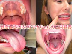 健康優良口内！なつきちゃんの日内観察