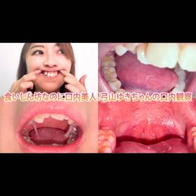 食いしん坊なのに口内美人！弓山ゆきちゃんの口内観察 nko08-4